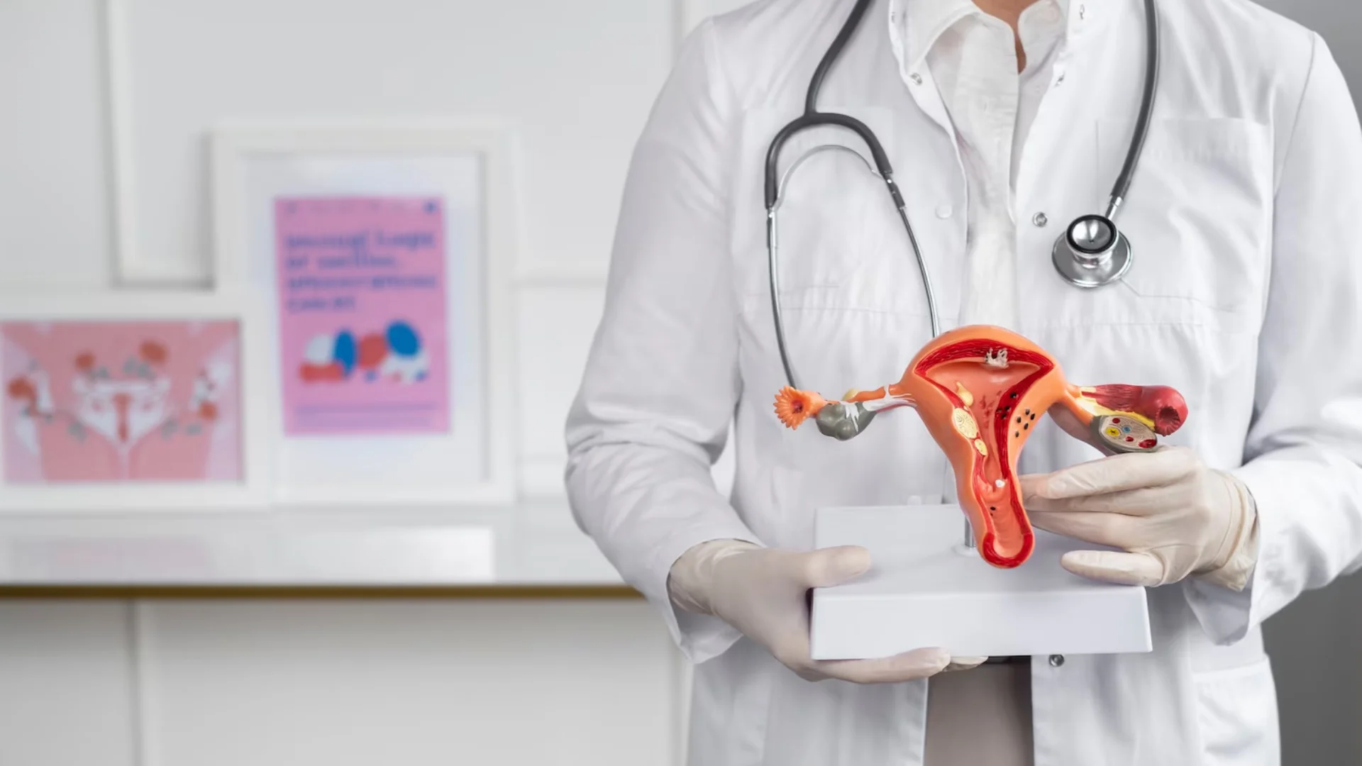 Laparoscopic Hysterectomy